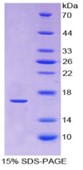 SDS-PAGE (RXFP1-6982H).jpg